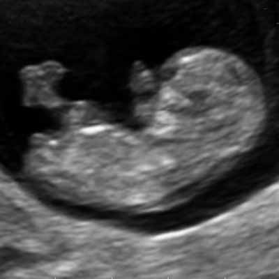 10 weken zwanger